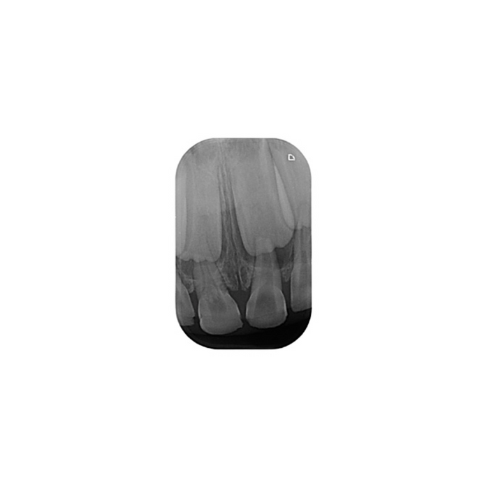 DURR DENTAL PHOSPHOR FILM PLUS FOR VISTASCAN