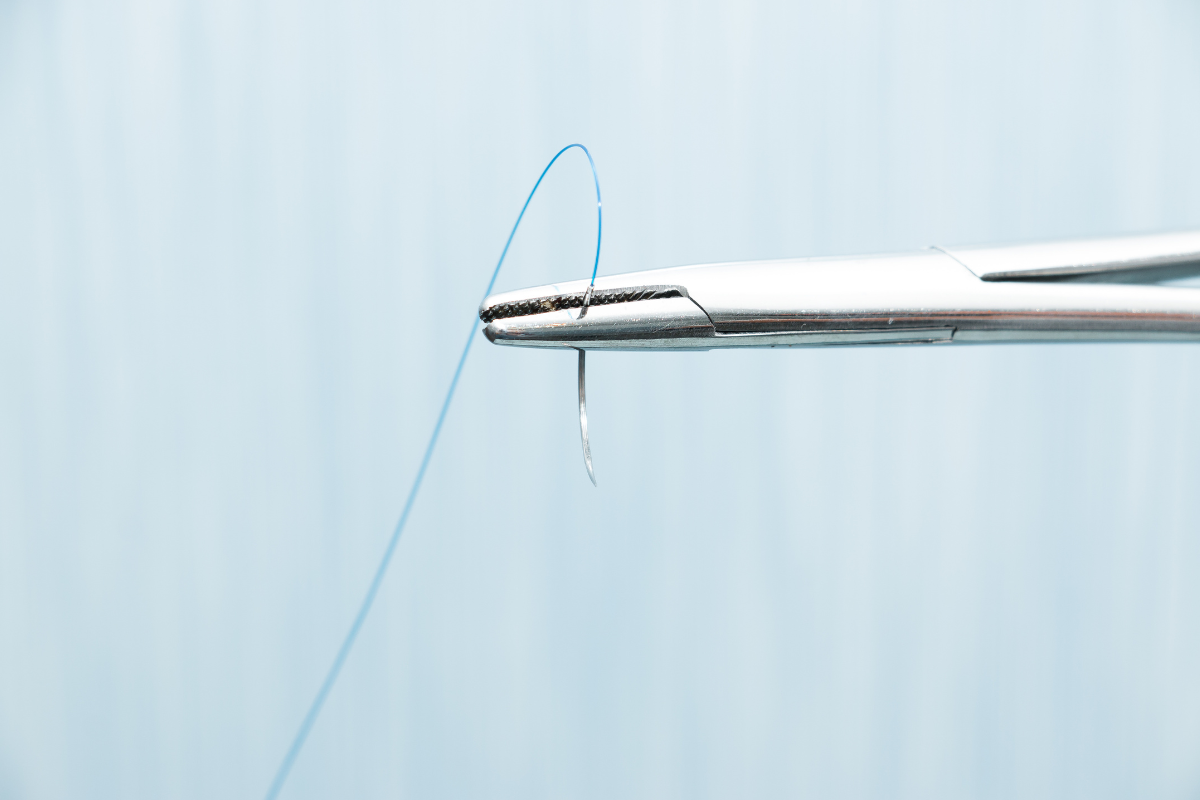 Suture in Odontoiatria: Guida alla scelta del materiale ideale per ogni lembo