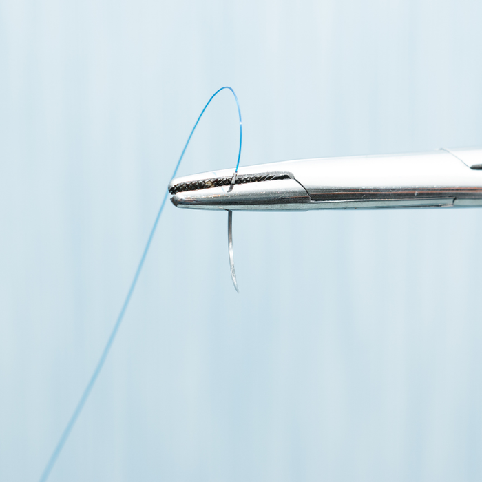 Suture in Odontoiatria: Guida alla scelta del materiale ideale per ogni lembo