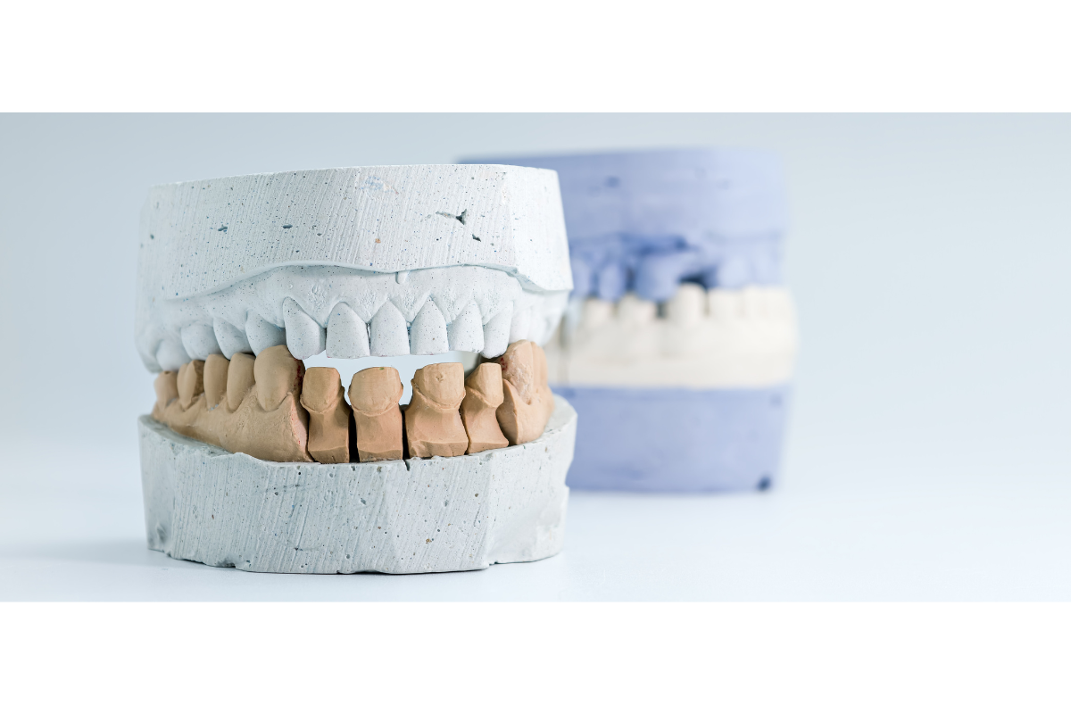 Dal Gesso al Bit: La Guida Definitiva alla Precisione nel Laboratorio Moderno