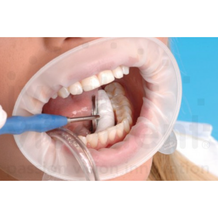 IVOCLAR OPTRAGATE 80px.