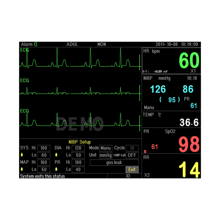 GIMA Monitor Multiparametrico PC-3000 Parametri Vitali